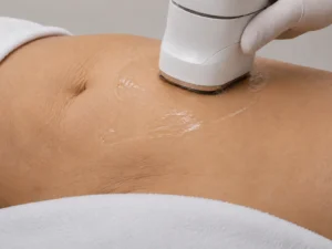 hifu abdomen