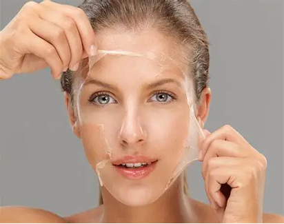 peeling químico 2 sesiones 30 min. peeling químico 2 sesiones 30 min.