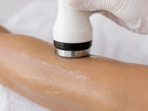 radiofrecuencia corporal 6 sesiones (abdomen, brazos, muslos)