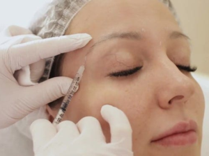 botox full face 30 min.